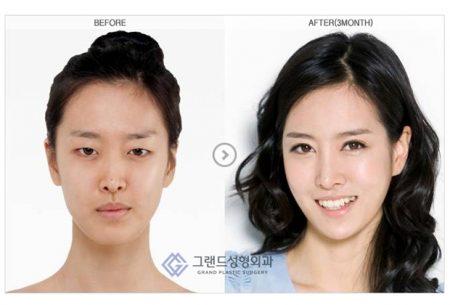 Опа, Каннам-стайл