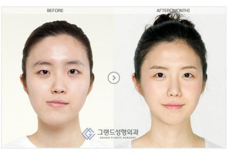 Опа, Каннам-стайл