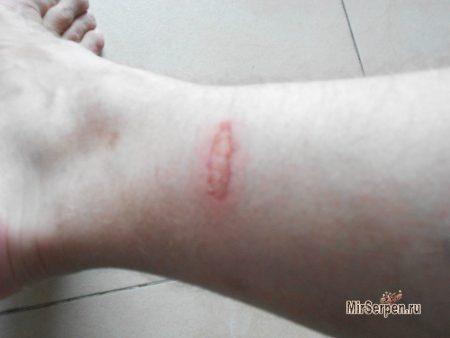 Рыба-спа - когда вас грызут за ваши деньги